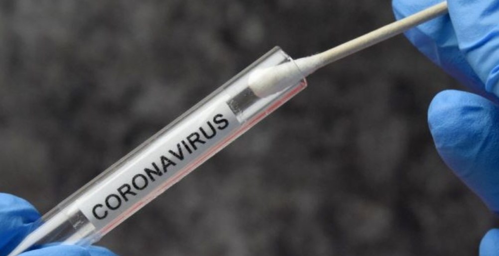 1 228 са новите случаи на коронавирус при направени 11